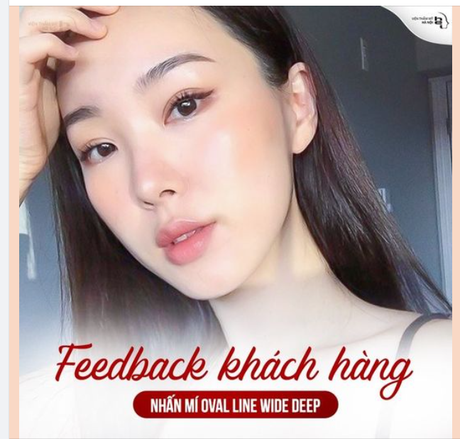 NHẤN MÍ OVAL LINE WIDE DEEP