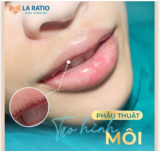 TẠO HÌNH MÔI - SẮC ĐẸP NHÂN ĐÔI