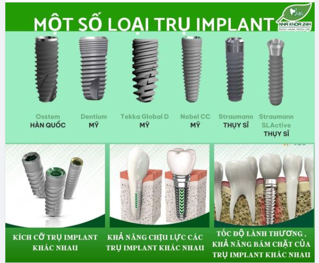 SỰ KHÁC BIỆT GIỮA CÁC LOẠI TRỤ IMPLANT NÊN LỰA CHỌN CẤY GHÉP IMPLANT LOẠI NÀO TỐT???