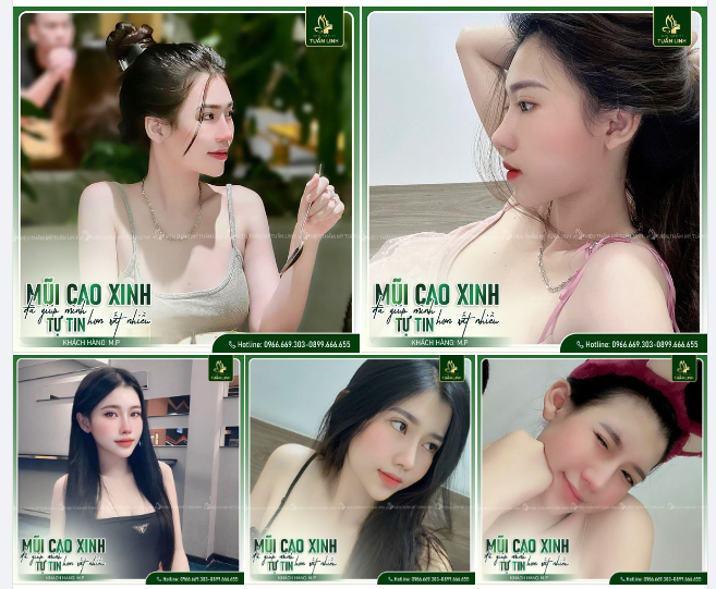 NÂNG CẤP GÓC NGHIÊNG - BỘI THU THÀNH CÔNG