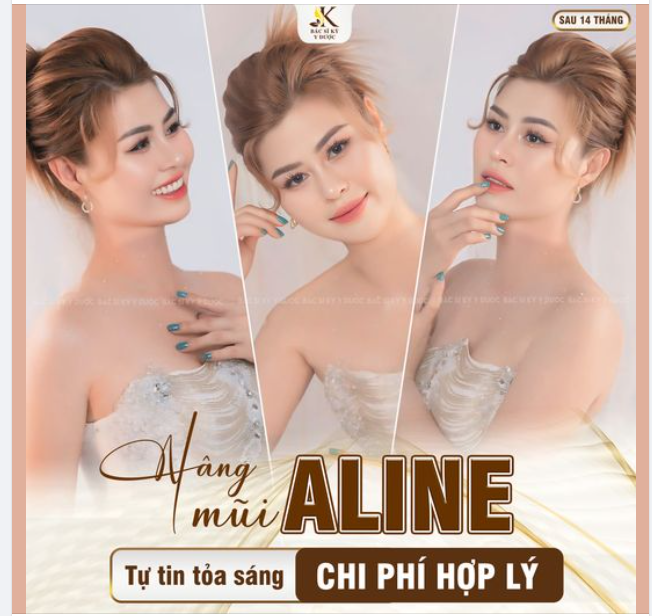 Thăng hạng nhan sắc nhờ Nâng Mũi ALINE tại Bác sĩ Kỳ Y Dược