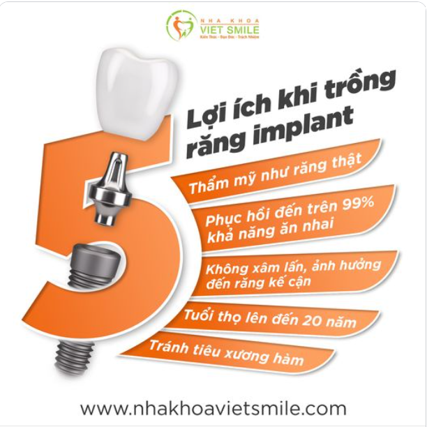 LỢI ÍCH KHI TRỒNG RĂNG IMPLANT LẤY LẠI RĂNG MẤT