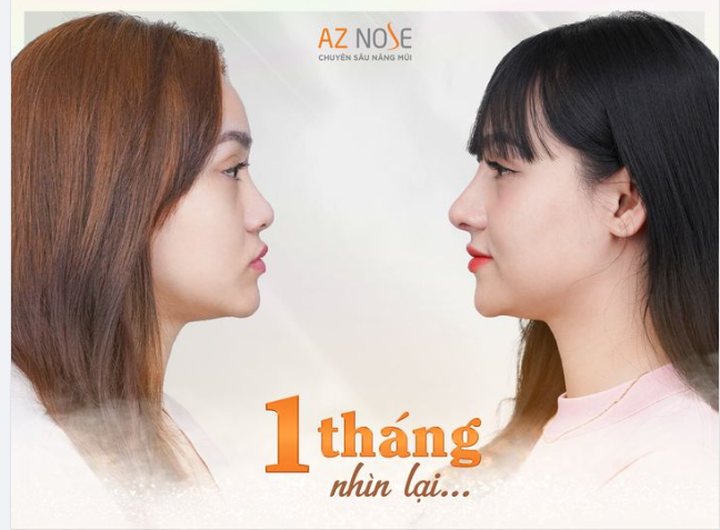 "Dáng mũi phù hợp" là yếu tố quan trọng giúp đường nét trên gương mặt hài hoà hơn.