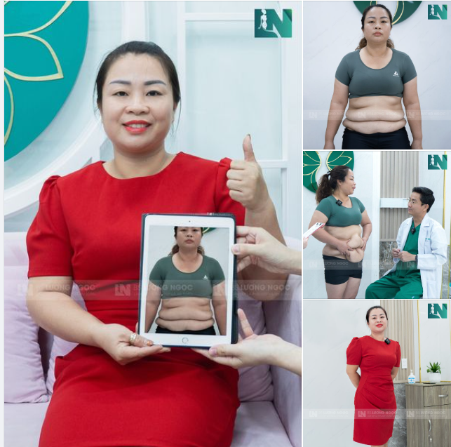 BỤNG MỠ TÍCH 10 NĂM BIẾN MẤT HOÀN TOÀN CHỈ SAU HƠN 60 PHÚT
