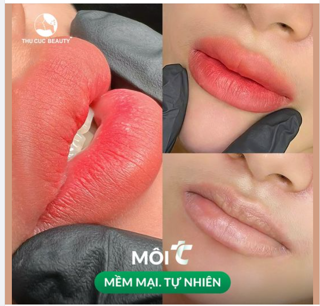 Hô biến môi thâm, môi nhạt thành đôi môi căng mọng, tự nhiên