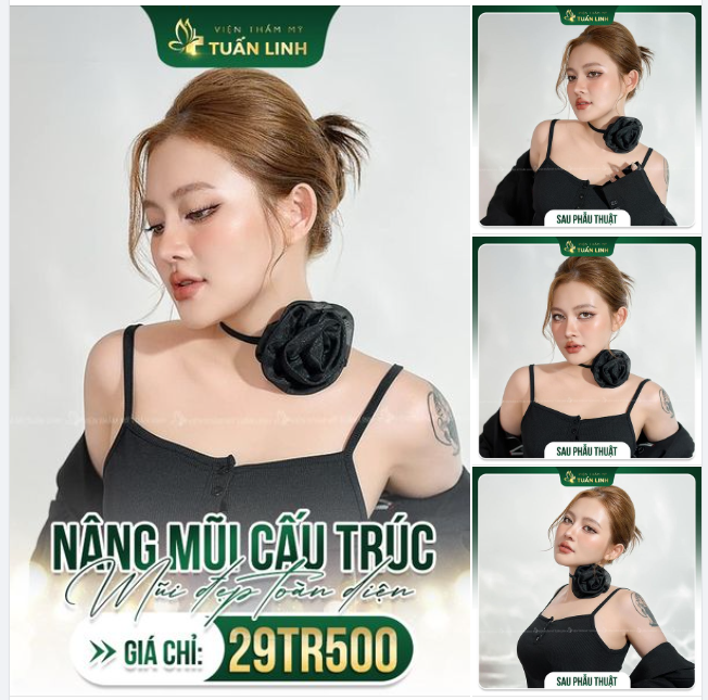 ĐẾN TUẤN LINH SỞ HỮU DÁNG MŨI “CỰC PHẨM” NÂNG CẤP DIỆN MẠO!!