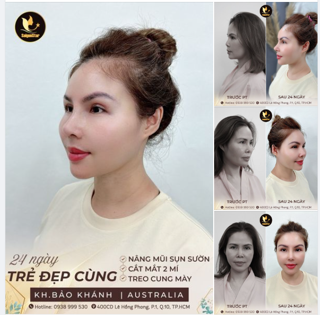 KHÁCH HÀNG VIỆT KIỀU ÚC "LỘT XÁC" BẤT NGỜ VỚI COMBO TRẺ ĐẸP SAU 24 NGÀY