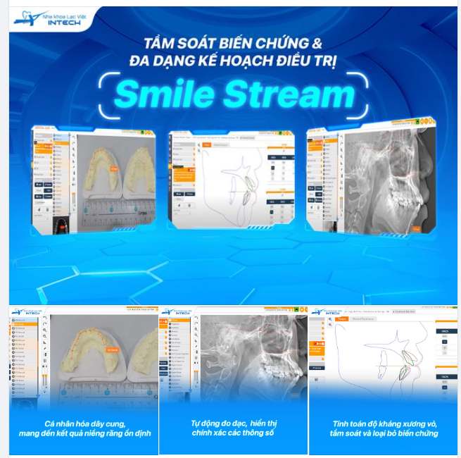 PHÂN TÍCH PHIM VỚI SMILESTREAM ƯU VIỆT NHƯ THẾ NÀO?