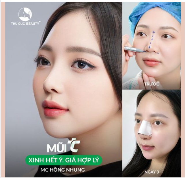 SỐC: Gấp đôi visual sau nâng mũi là có thật!