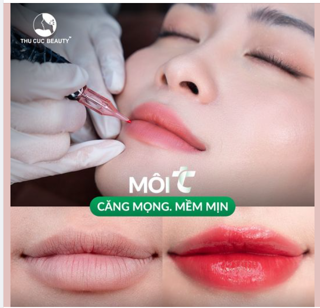 Một đôi môi căng mọng, tươi tắn giờ đây không còn là niềm mơ ước xa vời nữa