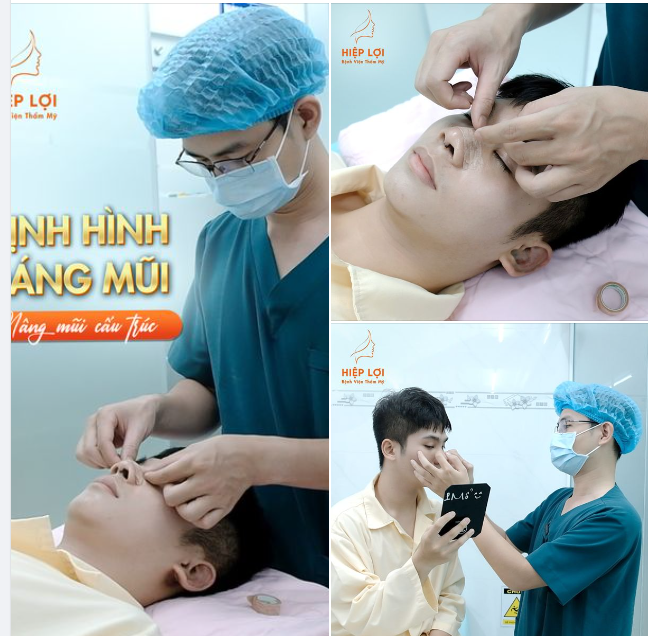 "Tái khám sau nâng mũi" có thực sự quan trọng?
