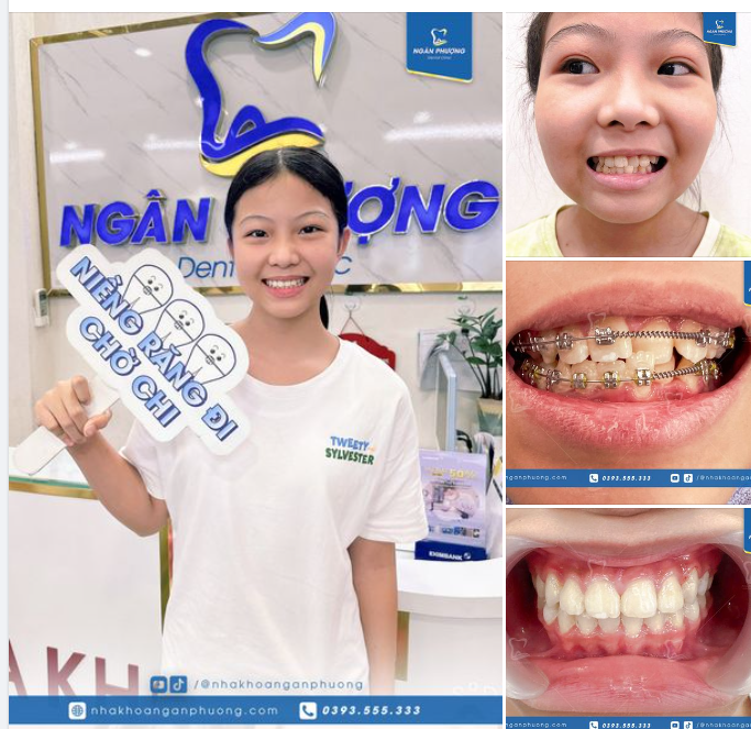 Chúc em chặng đường phía trước nhiều niềm vui và thành công với diện mạo mới nhé