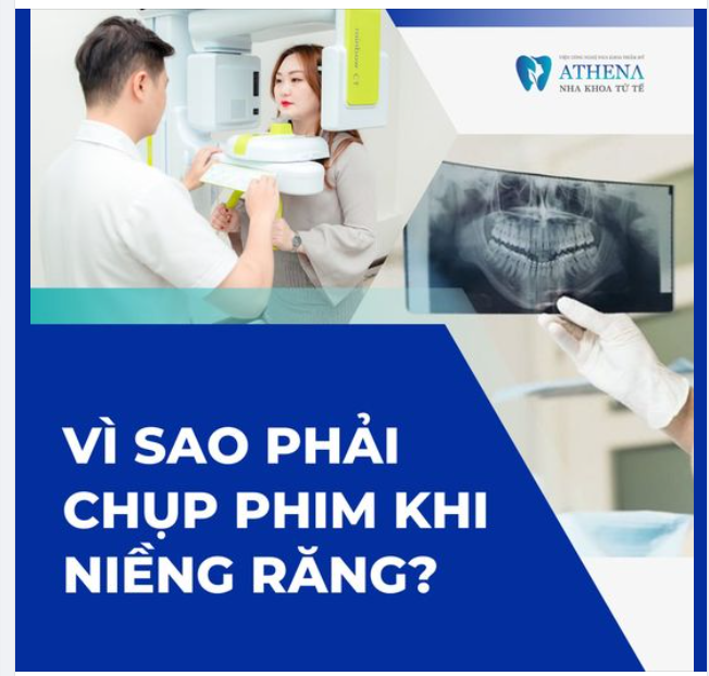 Vì sao phải chụp phim trước khi  niềng răng
