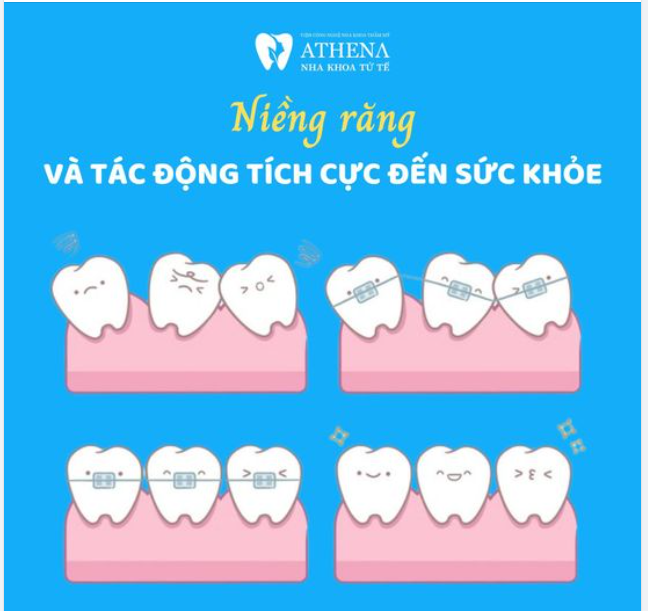Niềng răng và tác động tích cực đến sức khỏe tổng thể