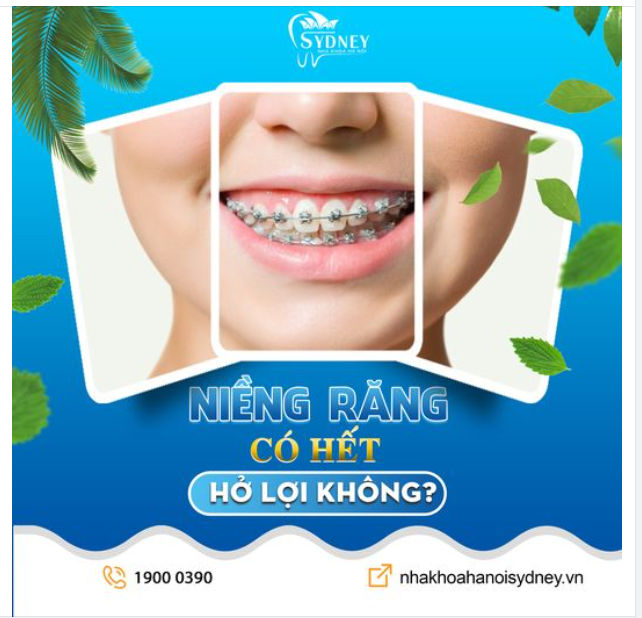 NIỀNG RĂNG CÓ HẾT HỞ LỢI KHÔNG?
