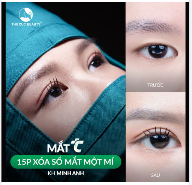 Chỉ cần thả tym bài viết có ngay ưu đãi Mắt TC -40%