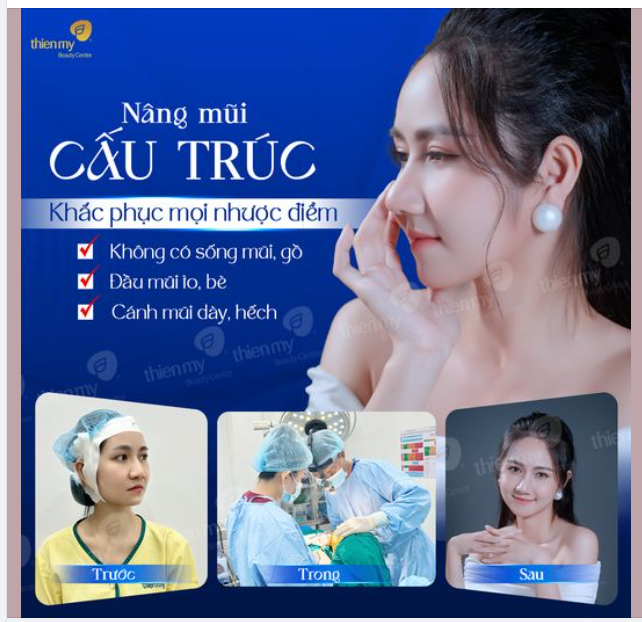Nâng mũi cấu trúc - Dáng mũi như ý