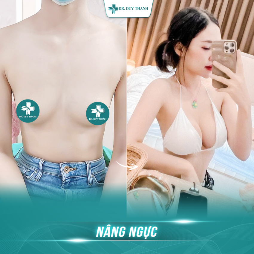 Dr Duy Thanh - Giải cứu thành công hàng ngàn ca nâng ngực, hút mỡ hỏng