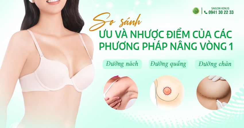 SO SÁNH ƯU VÀ NHƯỢC ĐIỂM CỦA CÁC ĐƯỜNG MỔ NÂNG NGỰC