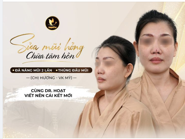 "GIẢI CỨU" MŨI HỎNG - SỤN SILICON ĐÂM THỦNG ĐẦU MŨI