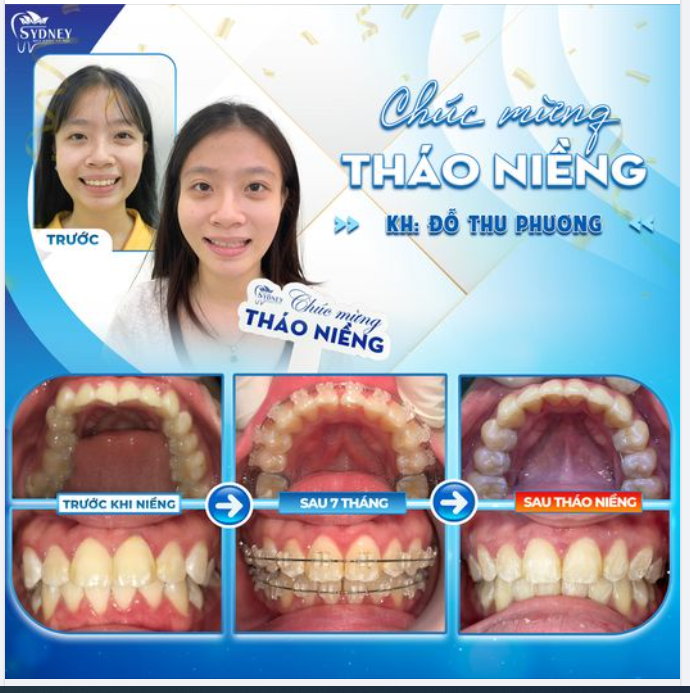 CHÚC MỪNG THÁO NIỀNG KH. THU PHƯƠNG