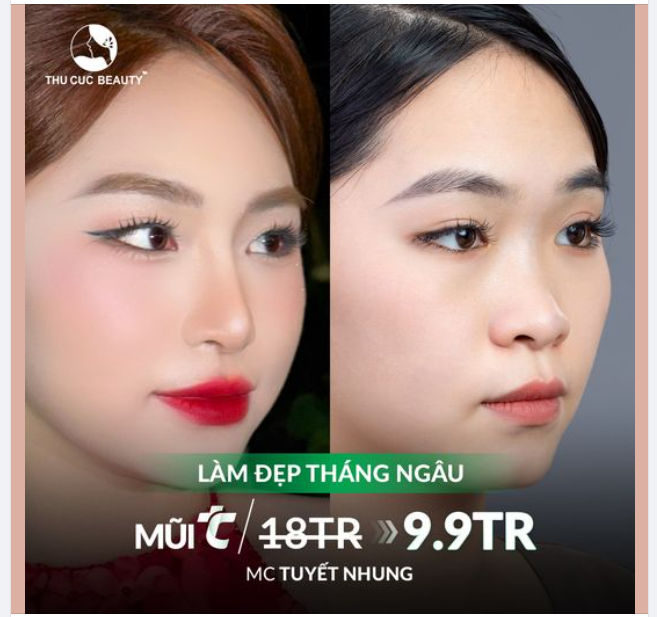 Nâng mũi tháng Ngâu - Giảm giá cực sâu chỉ từ 9.9TR