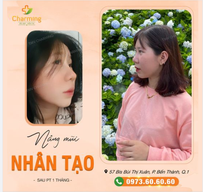 Nếu mọi người còn nghi ngờ hiệu quả của nâng mũi nhân tạo thì hãy nhìn nàng khách của Charming đây