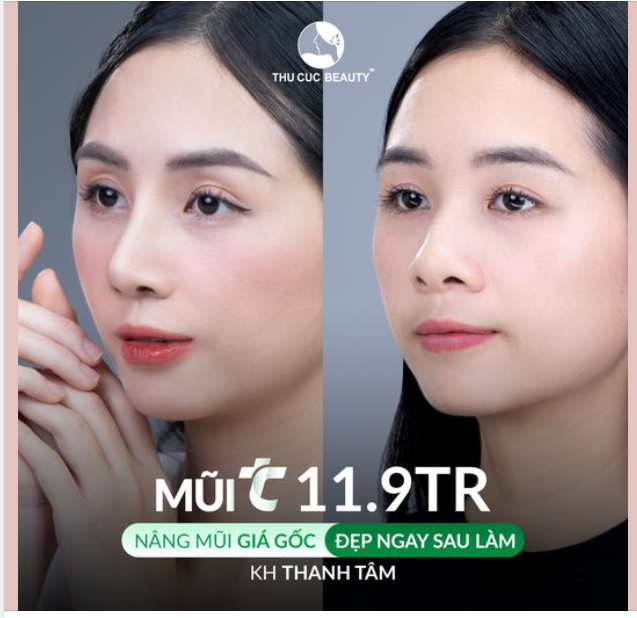 Cơ hội nâng mũi giá gốc từ 18Tr -11.9Tr Duy nhất tháng Ngâu  Đặt lịch ngay
