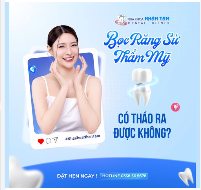 BỌC RĂNG SỨ THẨM MỸ CÓ THÁO RA ĐƯỢC KHÔNG ?