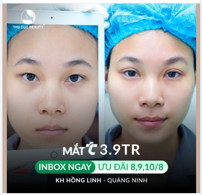 Chiêm ngưỡng dáng mí tự nhiên của KH Hồng Linh đến từ Quảng Ninh ngay dưới bài viết này!