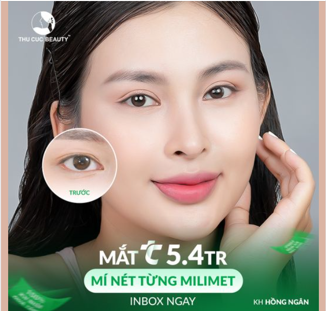 Tiết kiệm chi phí với Cắt Mắt TC giảm 40% Ưu đãi ngày kim cương Mắt TC chỉ từ 5.4Tr
