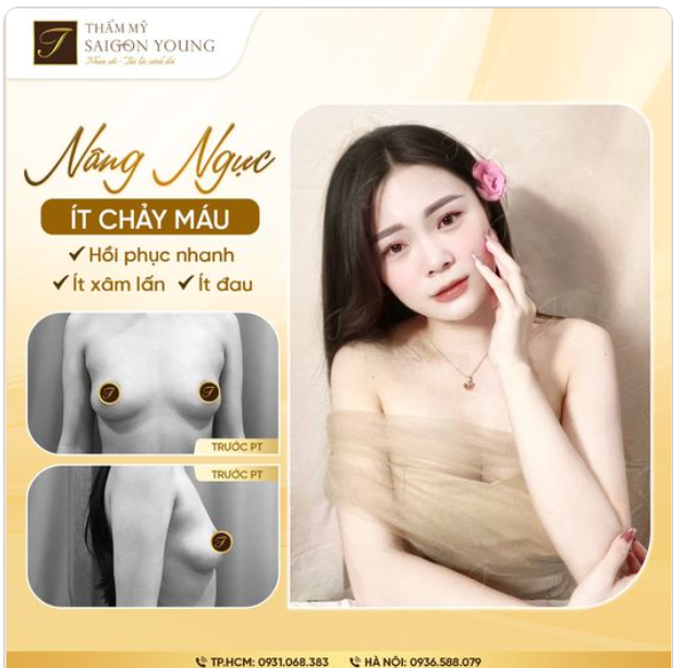 Tìm hiểu 4 năm mới thẩm mỹ V1 và cái kết....Cái kết chính là vẻ đẹp trong trẻo, rạng rỡ của Ngọc Vy.