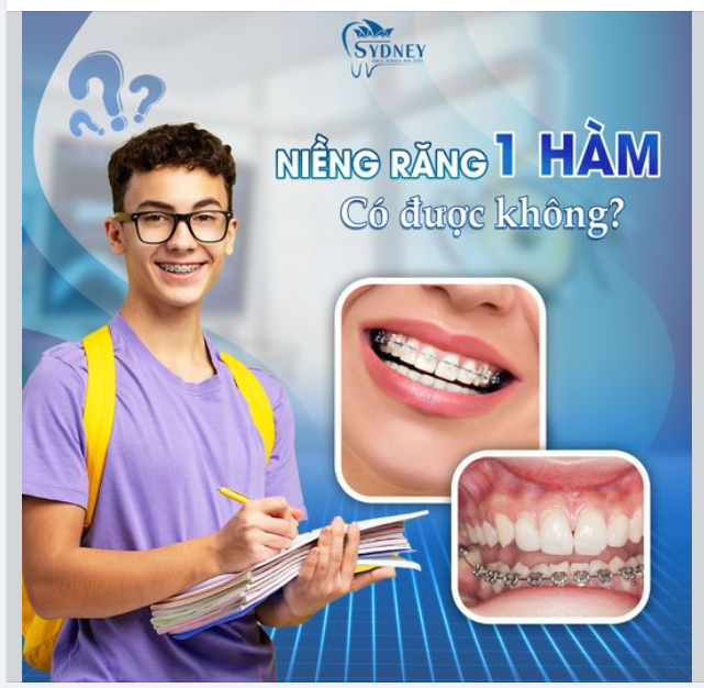 NIỀNG RĂNG MỘT HÀM CÓ ĐƯỢC KHÔNG?