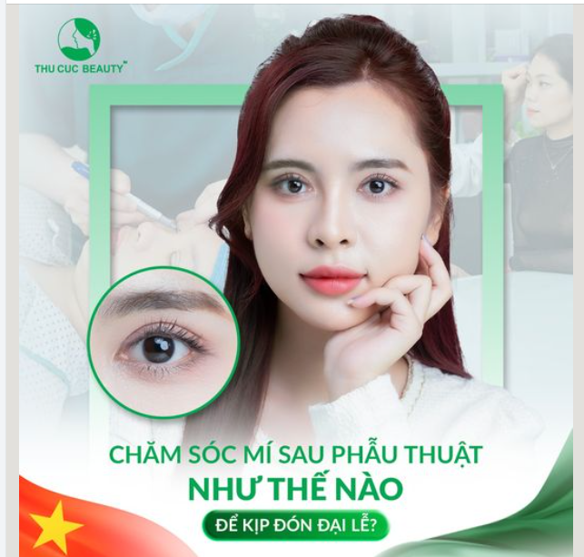 Chăm sóc mí sau phẫu thuật thế nào để kịp đón ĐẠI LỄ ?