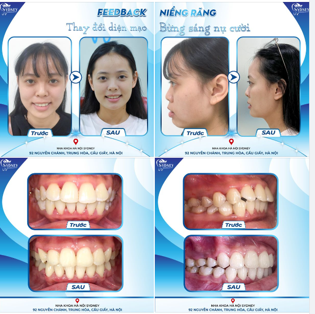 THAY ĐỔI DIỆN MẠO - BỪNG SÁNG NỤ CƯỜI