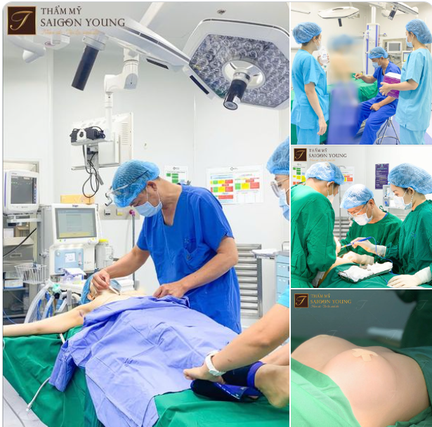 Bạn biết không: bác sĩ nâng ngực cho bạn, cũng giống như một người thợ may trang phục của bạn.