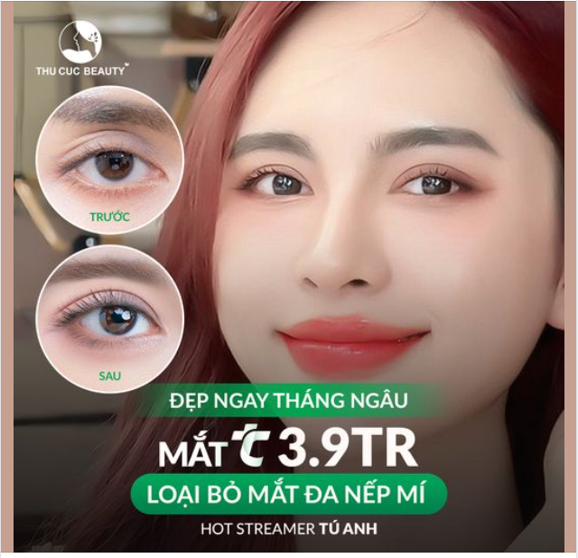Loại bỏ ngay tình trạng đa nếp mí cùng Mắt TC chỉ từ 3.9Tr