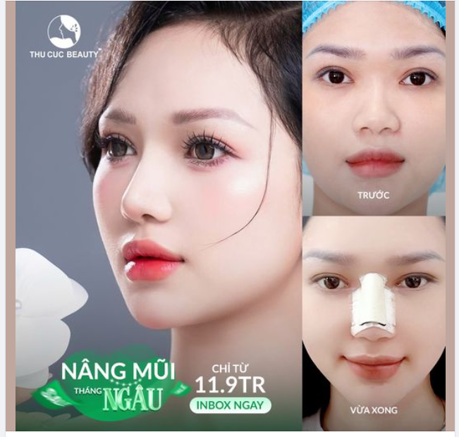 10 suất Mũi TC cho khách hàng chỉ từ 11.9Tr dành tặng chị em trong tháng này