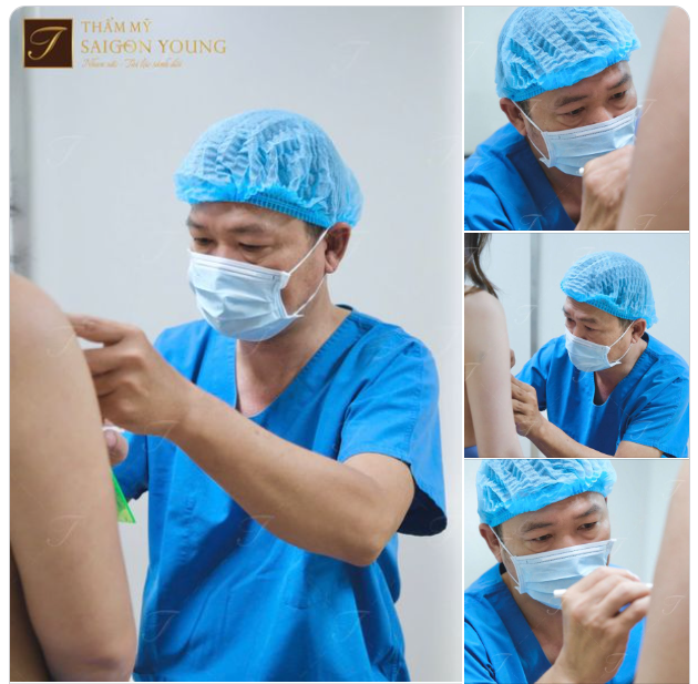 Đo vẽ trước khi thực hiện nâng ngực.