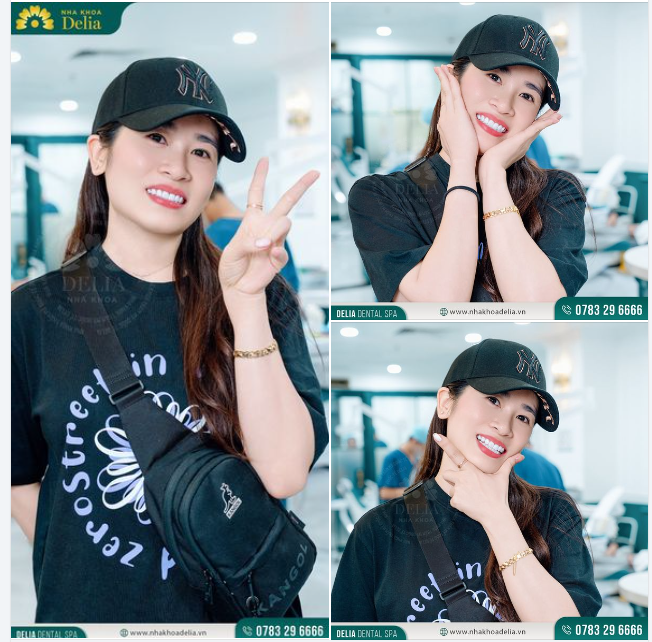 CÓ RĂNG ĐẸP TỰ TIN NỞ NỤ CƯỜI