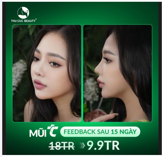 KH Hồng Nhung khoe nhẹ dáng mũi cao bay chỉ sau 15 ngày