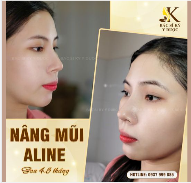 GƯƠNG MẶT “NHẠT NHÒA” VÌ DÁNG MŨI “BẤT LỢI”?