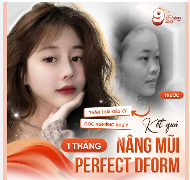 Dáng mũi cao nhẹ nhàng cho cô nàng đến từ Gia Lai.