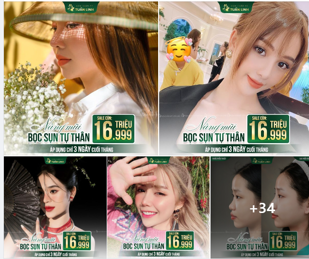 NÂNG MŨI SỤN TỰ THÂN SALE CÒN 16tr 999- CHỈ ÁP DỤNG 3 NGÀY CUỐI THÁNG CUỐI THÁNG!!