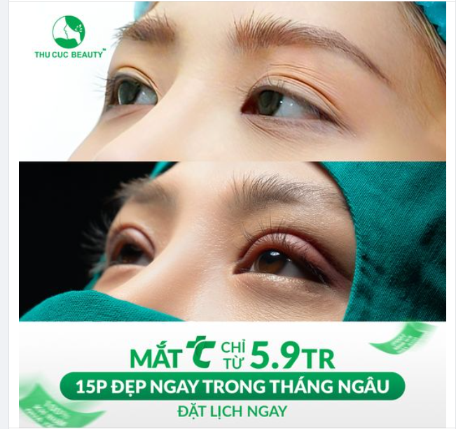 Không còn tự ti và phải dùng miếng dán kích mí mỗi ngày > Lựa chọn Mắt TC để sở hữu đôi mắt hai mí sắc nét