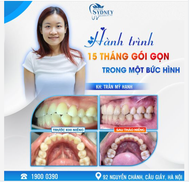 HÀNH TRÌNH 15 THÁNG GÓI GỌN TRONG MỘT BỨC HÌNH