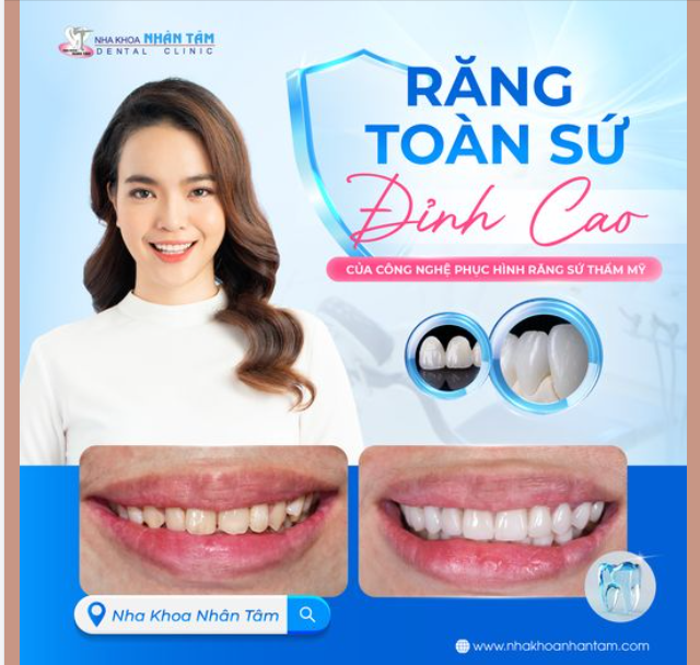 Răng toàn sứ - Đỉnh cao của công nghệ phục hình răng thẩm mỹ