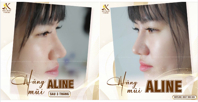 NGẮM NHÌN SỰ THAY ĐỔI CỦA BẠN ẤY