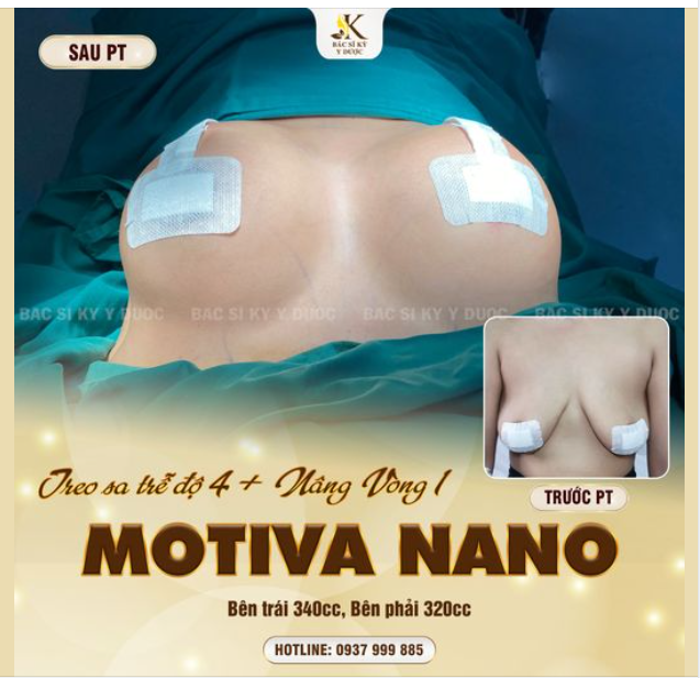 CÓ NHỮNG THAY ĐỔI "XUẤT SẮC" ĐẾN KHÔNG NGỜ