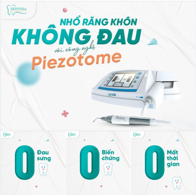 NHỔ RĂNG KHÔN KHÔNG ĐAU BẰNG MÁY SIÊU ÂM PIEZOTOME